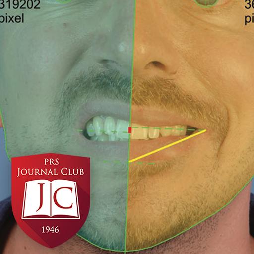 "Flap Debulking after Facial Reanimation" with Shai Rozen, MD - Jan. 2026 Journal Club