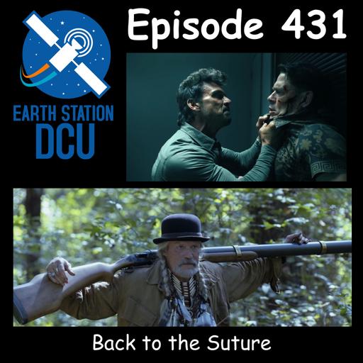 The Earth Station DCU Episode 431 – Back to the Suture