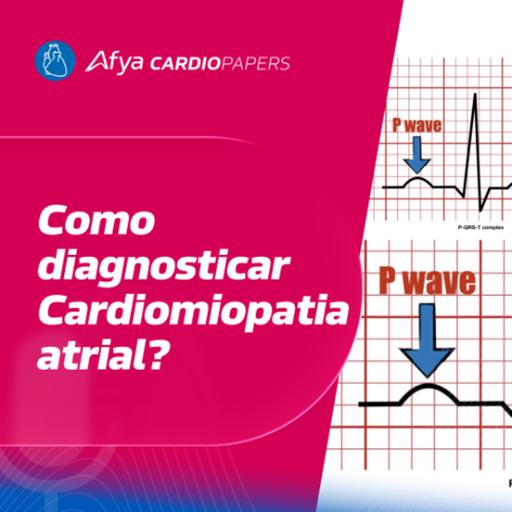 Cardiomiopatia atrial – Critérios Diagnósticos