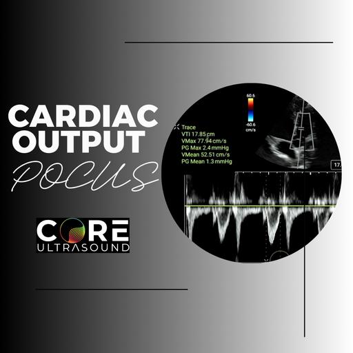 Measuring Cardiac Output Using Point-of-Care Ultrasound