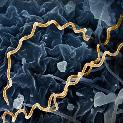 Syphilis: The Great Masquerader