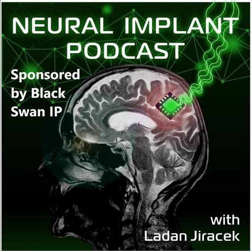 Ignacio Sáez - Neurotechnology for Cognition: Recording and Modulating the Human Brain