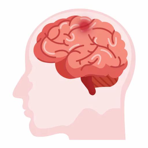 #221 - Central Auditory Processing Disorder (CAPD) and Cortical Visual Impairment (CVI) in Ds