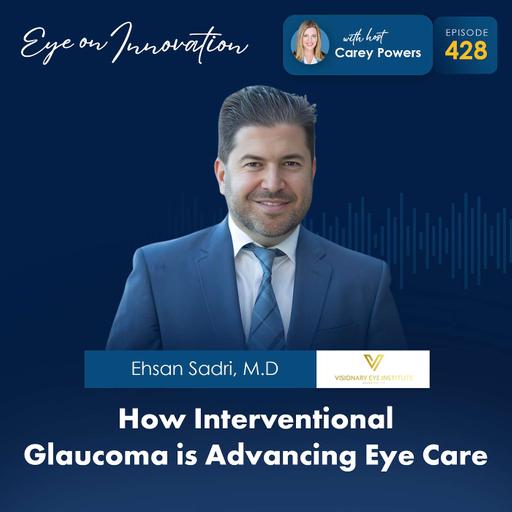 How Interventional Glaucoma is Advancing Eye Care