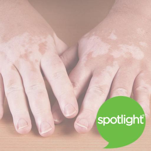 Changing Skin Color