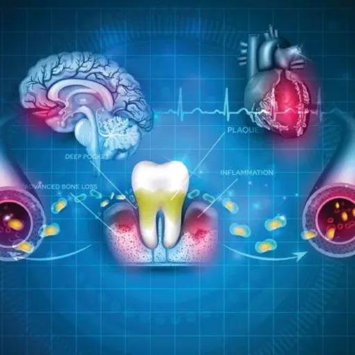 Audio Article: Research Explains Link Between Periodontal Disease and Overall Health