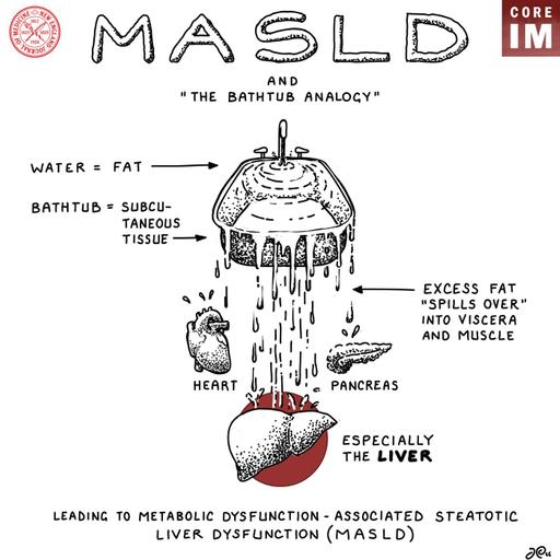 #211 Breaking Down MASLD vs. MASH and the MAESTRO-NASH & ESSENCE Trials: Beyond Journal Club Segment