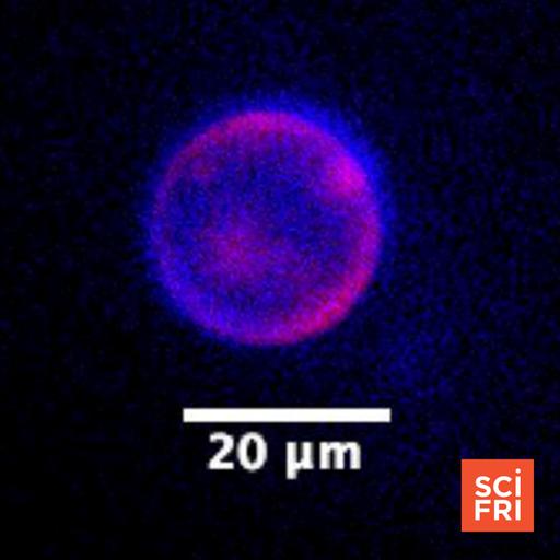 An artificial cell eats, grows, and reproduces. Is it alive?