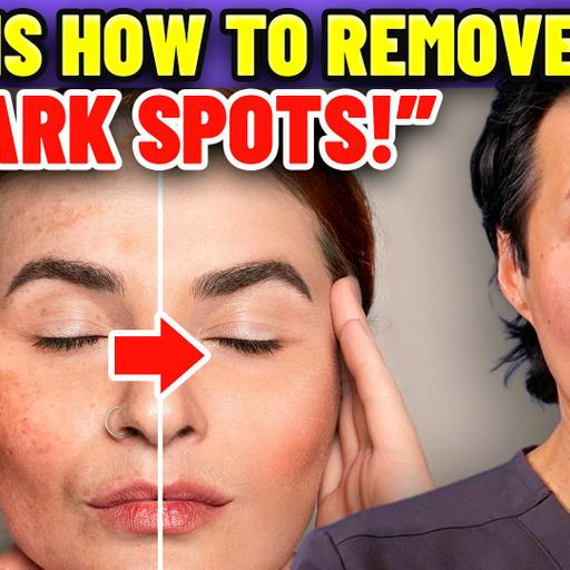 Why Your Dark Spots Won't Go Away (And How to Finally Fix Them)