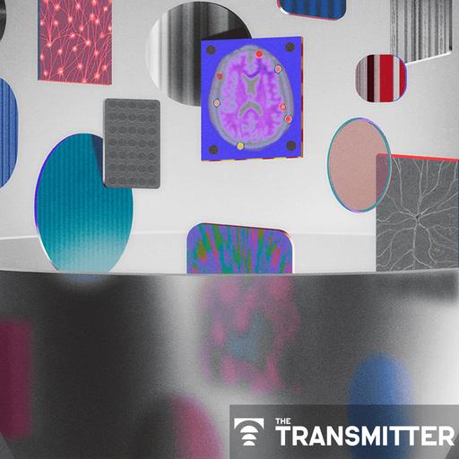 AI can't solve the brain without data that fit together