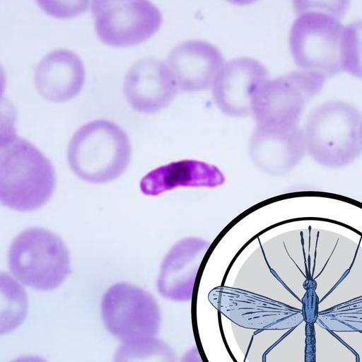 Sickle cell defeated malaria and opened up pastures new
