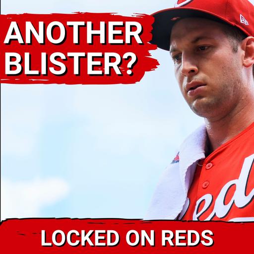 CRISIS: Cincinnati Reds Must SOLVE Nick Lodolo Blister Woes or RISK Losing Ace for Good