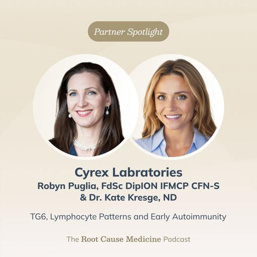 TG6, Lymphocyte Patterns and Early Autoimmunity