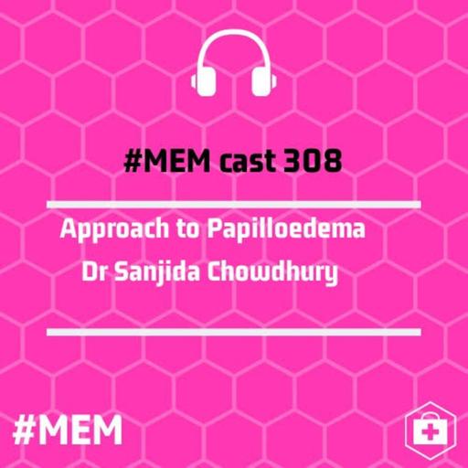 Episode 311: Approach to papilloedema