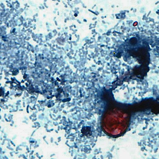 Why tracing cyclosporiasis is so tough, and a digestible probe for the microbiome