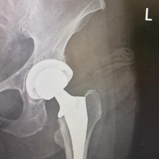 Hip, Hip, Hooray