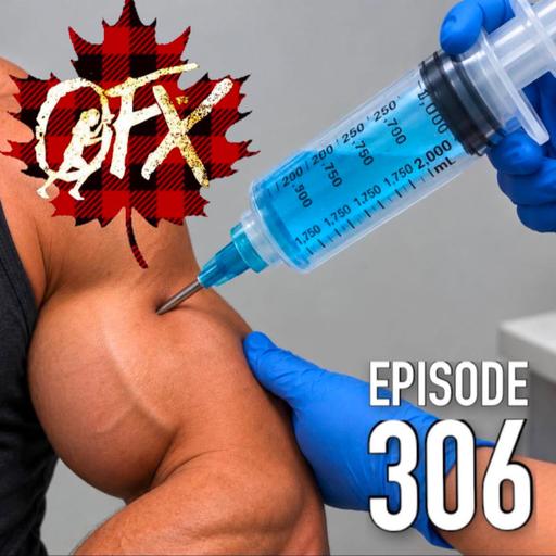 OFX EPISODE 306: JUST THE SHOT IN THE ARM YOU NEED.