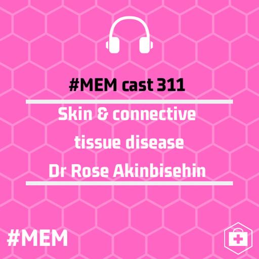 Episode 315: Skin and connective tissue disease
