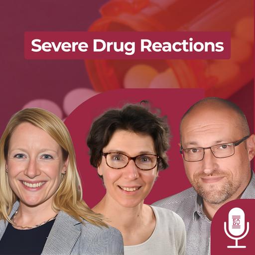 JD2609 | Severe Drug Reactions: When a Pill Turns the Immune System Against the Skin