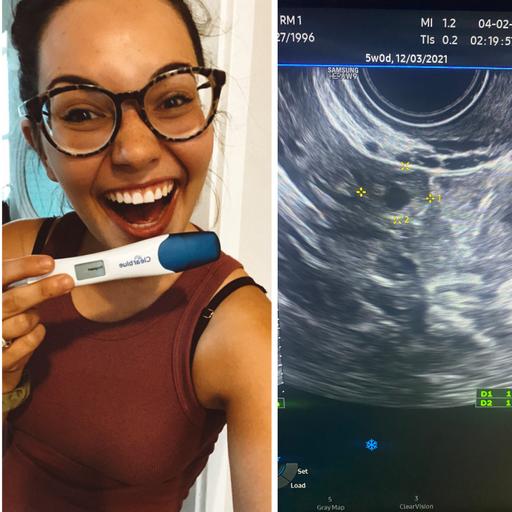 Episode 479 Lily's Miscarriage & Ectopic Pregnancy Stories | Pregnancy & Infant Loss Awareness Month