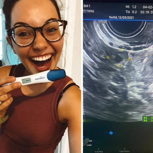 479 Lily's Miscarriage & Ectopic Pregnancy Stories | Pregnancy & Infant Loss Awareness Month