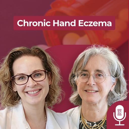 Chronic Hand Eczema: A Practical Q&A with the EADV Contact Dermatitis Task Force