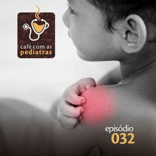 032 - Reações alérgicas